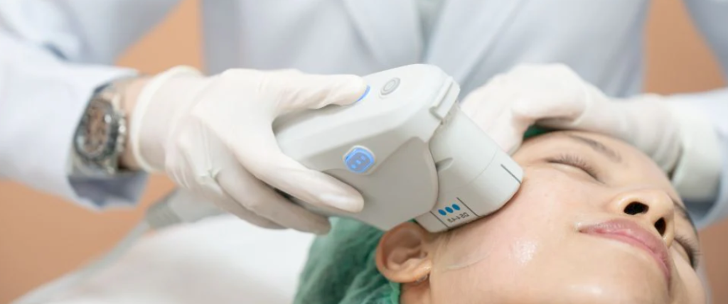 Ulthera第二代美版超聲刀效果怎麼樣?全面解析提升緊緻的真實成效插图2 谁适合做Ulthera第二代超声刀?